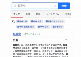 Yahoo!検索、専門医や医療機関の情報を元に正確な各種疾病情報の提供を開始