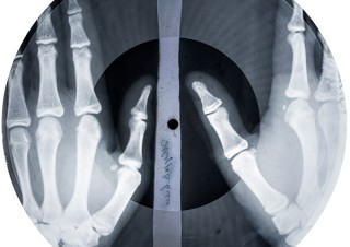 レントゲン写真に録音した“ボーン・レコード”の背景ストーリーを紹介する「BONE MUSIC展」