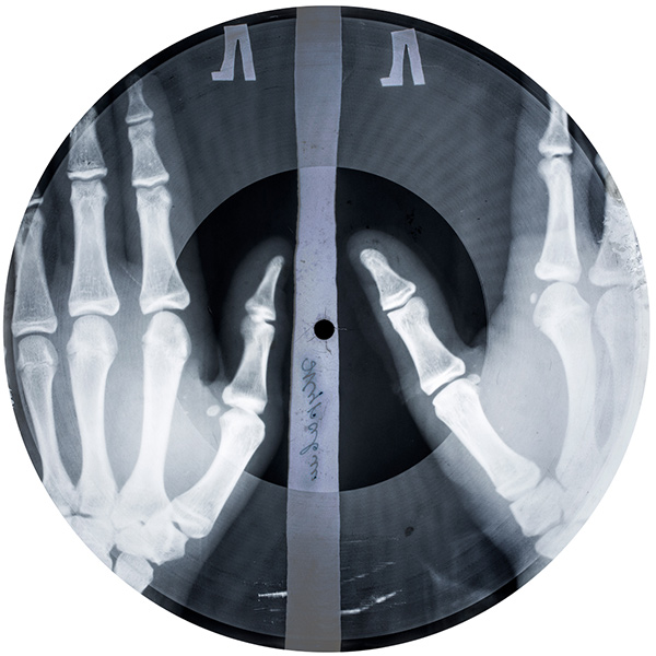 ボーン・レコード © Photography: X-Ray Audio Project / Paul Heartfield